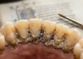 O pigmento encontrado nos dentes abriu uma pista inesperada sobre a profissão daquela mulher