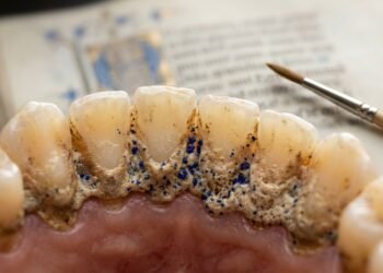 O pigmento encontrado nos dentes abriu uma pista inesperada sobre a profissão daquela mulher