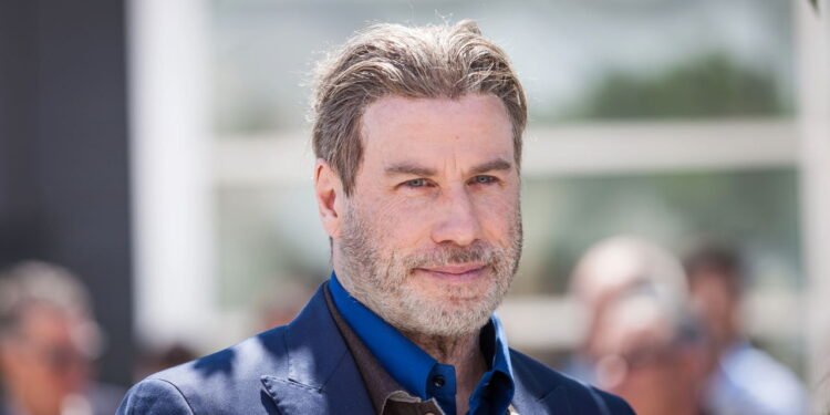 Ele dominou as pistas de dança e virou um ícone do cinema! Sabe quem é?