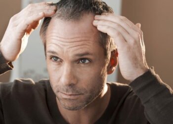 Como prevenir e tratar a queda de cabelo no dia a dia