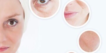 Veja como criar um botox caseiro com ingredientes simples para cuidados com a pele