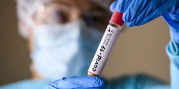 Rio de Janeiro tem 62% dos casos positivos da nova variante do vírus da covid-19