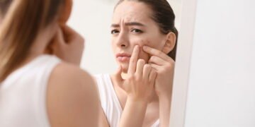 Espinhas insistentes? Veja o que pode estar causando seu surgimento
