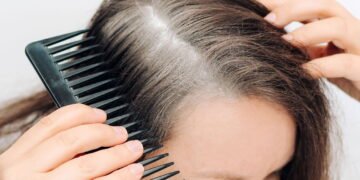 Métodos naturais para escurecer os fios brancos do seu cabelo