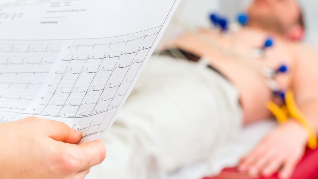 Quem tem arritmias cardíacas pode fazer exercícios físicos? Saiba as orientações e riscos