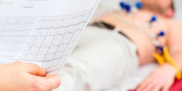 Quem tem arritmias cardíacas pode fazer exercícios físicos? Saiba as orientações e riscos