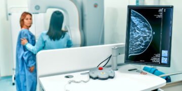 Nova tecnologia promete facilitar a detecção de câncer em pacientes com mamas densas