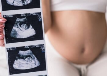 Mulher apresentando exames de ultrassonografia durante gravidez