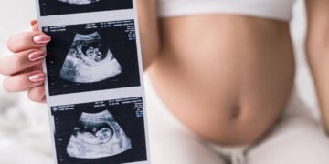 Mulher apresentando exames de ultrassonografia durante gravidez