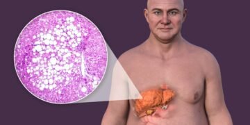 Representação 3d da goruda no fígado de seres humanos