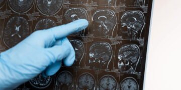 O que esse cientista faz com o cérebro está surpreendendo o mundo