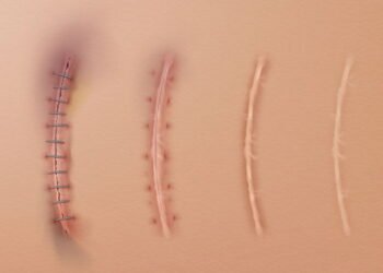 Esses alimentos aceleram a cicatrização natural do corpo de forma surpreendente