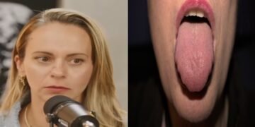 Dra. Priscila Antunes, médica, “Raspar a língua antes de beber água pode fazer isso com sua saúde”