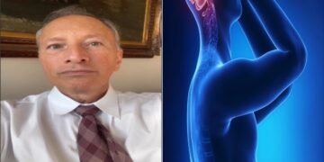 Dr. Alexandre Feldman, neurologista, diz que enxaqueca é só a ponta do iceberg