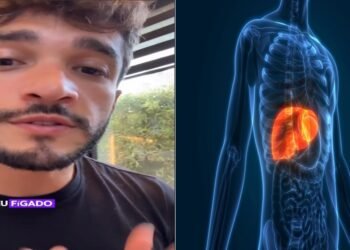 Dr. Márcio Crisóstomo, especialista em transplante capilar: “Minoxidil não resolve. Veja o que realmente funciona”