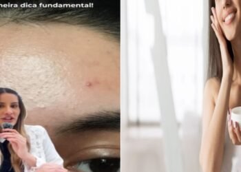 Dra. Caroline Aguiar, dermato “Para que serve e como usar a Niacinamida?”