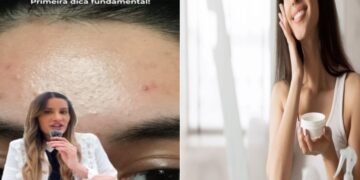 Dra. Caroline Aguiar, dermato “Para que serve e como usar a Niacinamida?”