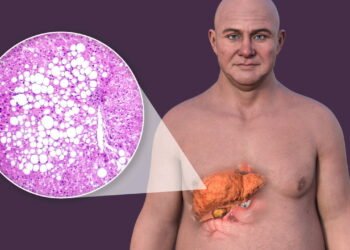 Dr. Bruno Monteze: “você prefere tomar remédio, mas poderia tratar com jejum”