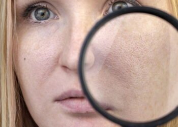 Os 6 melhores alimentos que ajudam a controlar a oleosidade da pele