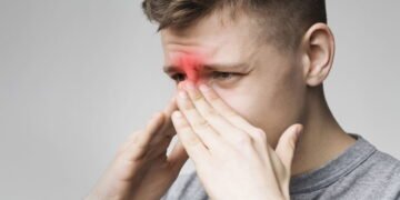 Cirurgia para rinite existe? Dr. Carlos Maurício explica mais sobre o assunto