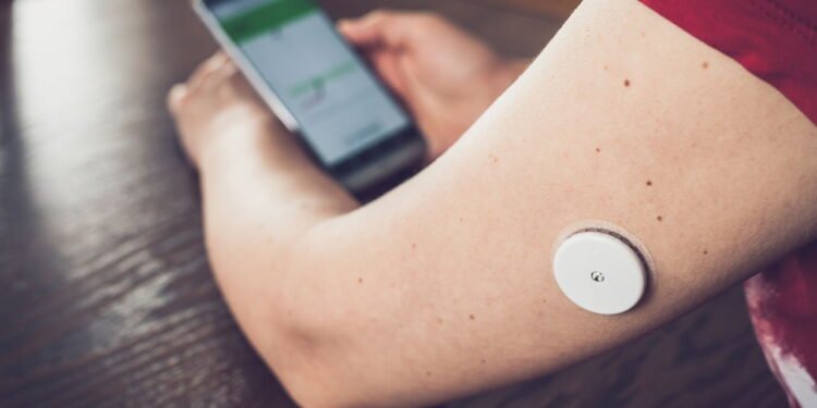 Novo aliado da saúde, o que são os sensores implantáveis?