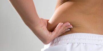 Dra Caroline Aguiar, Dermatologista, “parece sobrepeso, mas não é”; saiba identificar a condição