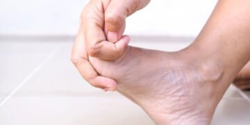 Por que a sola do pé dói tanto nos primeiros passos do dia