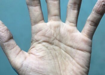 Por que nossos dedos enrugam na água? A ciência explica o motivo curioso