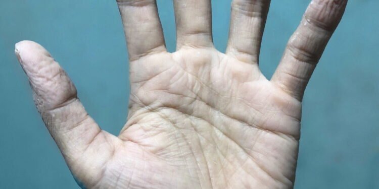 Por que nossos dedos enrugam na água? A ciência explica o motivo curioso