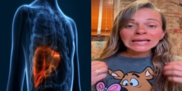 Dra. Priscila Antunes, nutróloga: “Se você já está com estes sintomas, precisa rever a saúde do seu fígado”