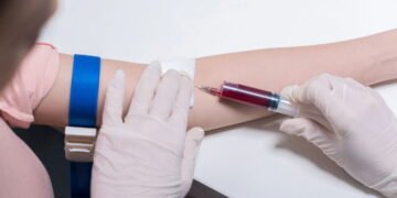 Exames essenciais após os 50 anos para manter a saúde em dia