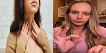 Dra. Priscila Antunes, médica especialista: “Seu rosto pode estar te dando sinais importantes”