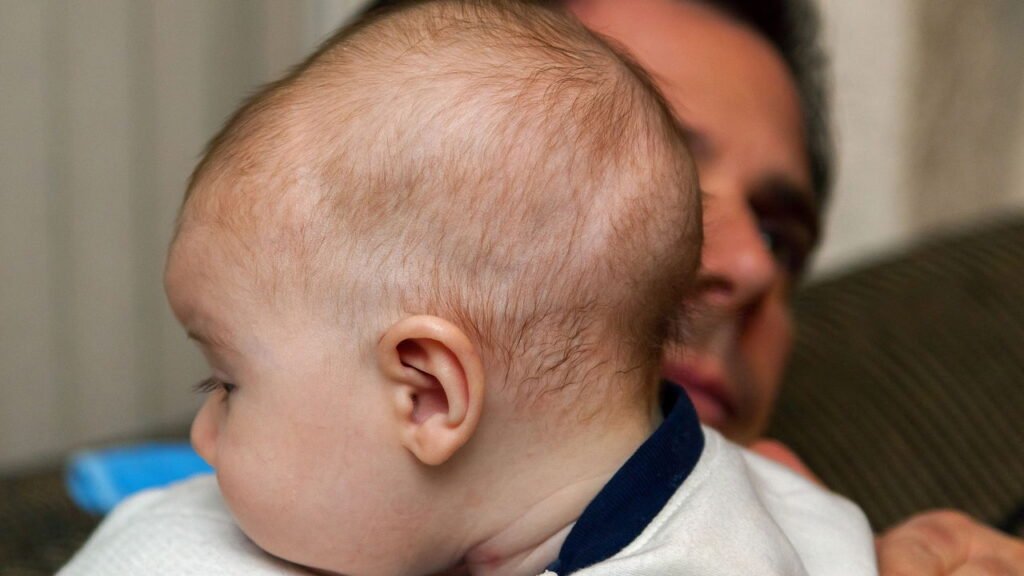 Bebê precisa arrotar sempre após as mamadas? Veja o que dizem os pediatras