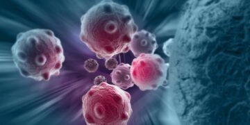 7 sintomas silenciosos de câncer que merecem atenção imediata