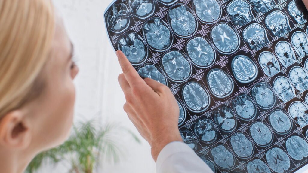 Você sabia que o cérebro pode melhorar mesmo após os 60 anos?