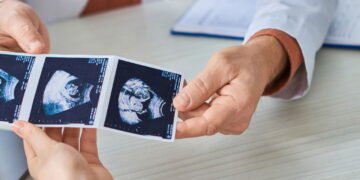 Dra. Cecilia Erthal, Ginecologista: Malformações Uterinas podem afetar a fertilidade?