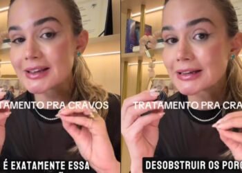Drª. Ana Carolina, dermatologista: “Este é o melhor produto para eliminar cravos”
