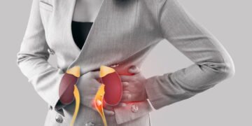 Como prevenir pedras nos rins? Dra. Gizele explica as principais causas e cuidados