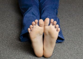 5 sinais nos pés que podem indicar problemas de saúde graves