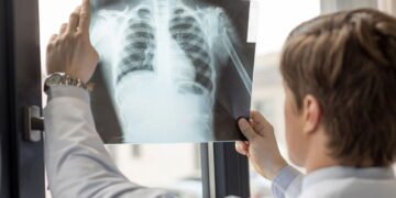 Dr. Felipe Roth, radiologista: Radiação em exames é vilã ou aliada?