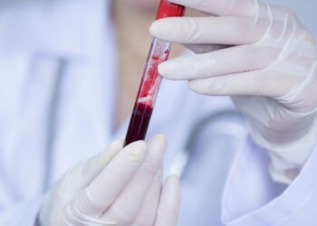 Estudo revela que esse tipo sanguíneo tem 28% de morte em lesões graves