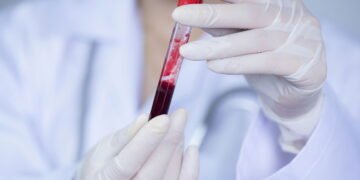 Estudo revela que esse tipo sanguíneo tem 28% de morte em lesões graves