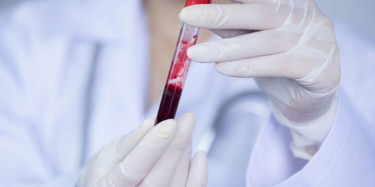 Estudo revela que esse tipo sanguíneo tem 28% de morte em lesões graves