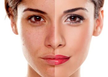 Rejuvenescimento facial virou prioridade para quem tem mais de 30