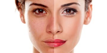 Rejuvenescimento facial virou prioridade para quem tem mais de 30