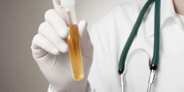 “A cor da sua urina é quem vai indicar se você está bebendo água o suficiente”; Nutricionista Matheus D’Avila mostra 3 exemplos