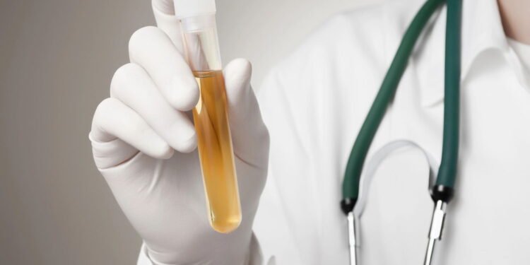 Médico segurando exame de urina - Créditos: depositphotos.com / Vonschonertagen