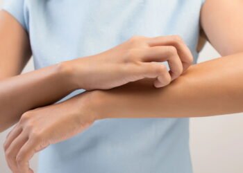 Saiba como identificar alergias alimentares em crianças de forma rápida e fácil através da pele