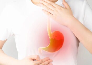 Gastroenterologista diz que 'mascar chiclete sem açúcar após as refeições e dormir à esquerda' reduz a azia