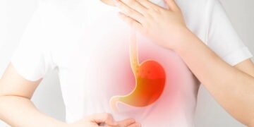 Gastroenterologista diz que 'mascar chiclete sem açúcar após as refeições e dormir à esquerda' reduz a azia